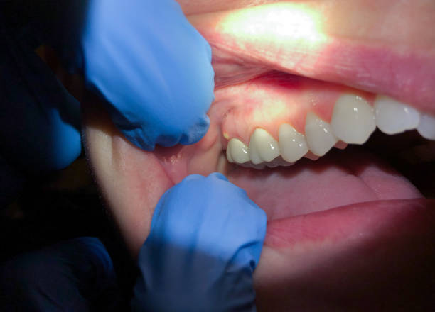 Best After-Hours Emergency Dentist in Dulles Town Center, VA