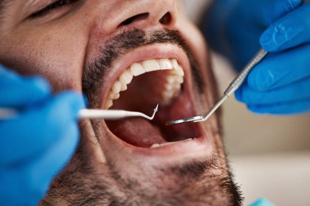 Best Emergency Tooth Extraction in Dulles Town Center, VA