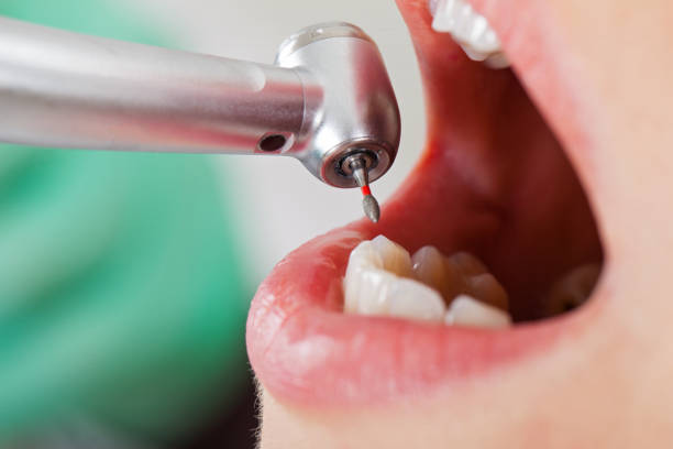 Best Emergency Dental Care for Trauma or Injury in Dulles Town Center, VA